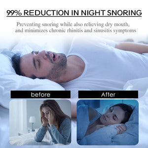 EELHOE Stress Relief Nasal Breathing Anti Snoring Patch Mouth Tape Sleep Strips Anti Snore Closed Mouth Care Adult Snoring Mask