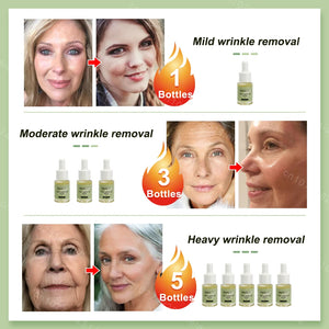 facial neck hand feet Anti-wrinkle  wrinkle removal essence anti aging serum skin care Lift tighten reduce fine lines moisturize