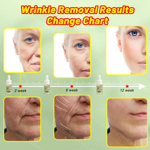 facial neck hand feet Anti-wrinkle  wrinkle removal essence anti aging serum skin care Lift tighten reduce fine lines moisturize