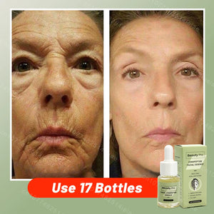 facial neck hand feet Anti-wrinkle  wrinkle removal essence anti aging serum skin care Lift tighten reduce fine lines moisturize